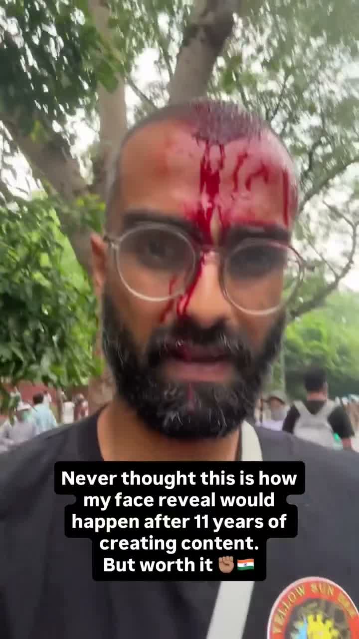 Content creator shows a bleeding head wound sustained at the protest
